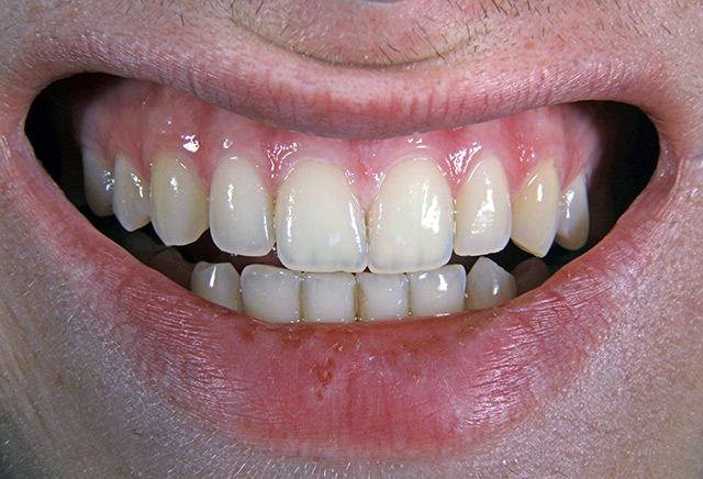 strong teeth and gums