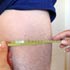 gluteal thigh girth measurement