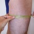 middle thigh girth measurement