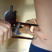 Iliac Crest skinfold pinch
